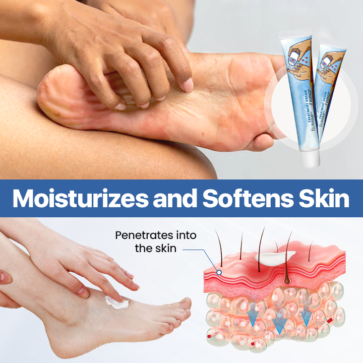 Diabetes Treatment Cream