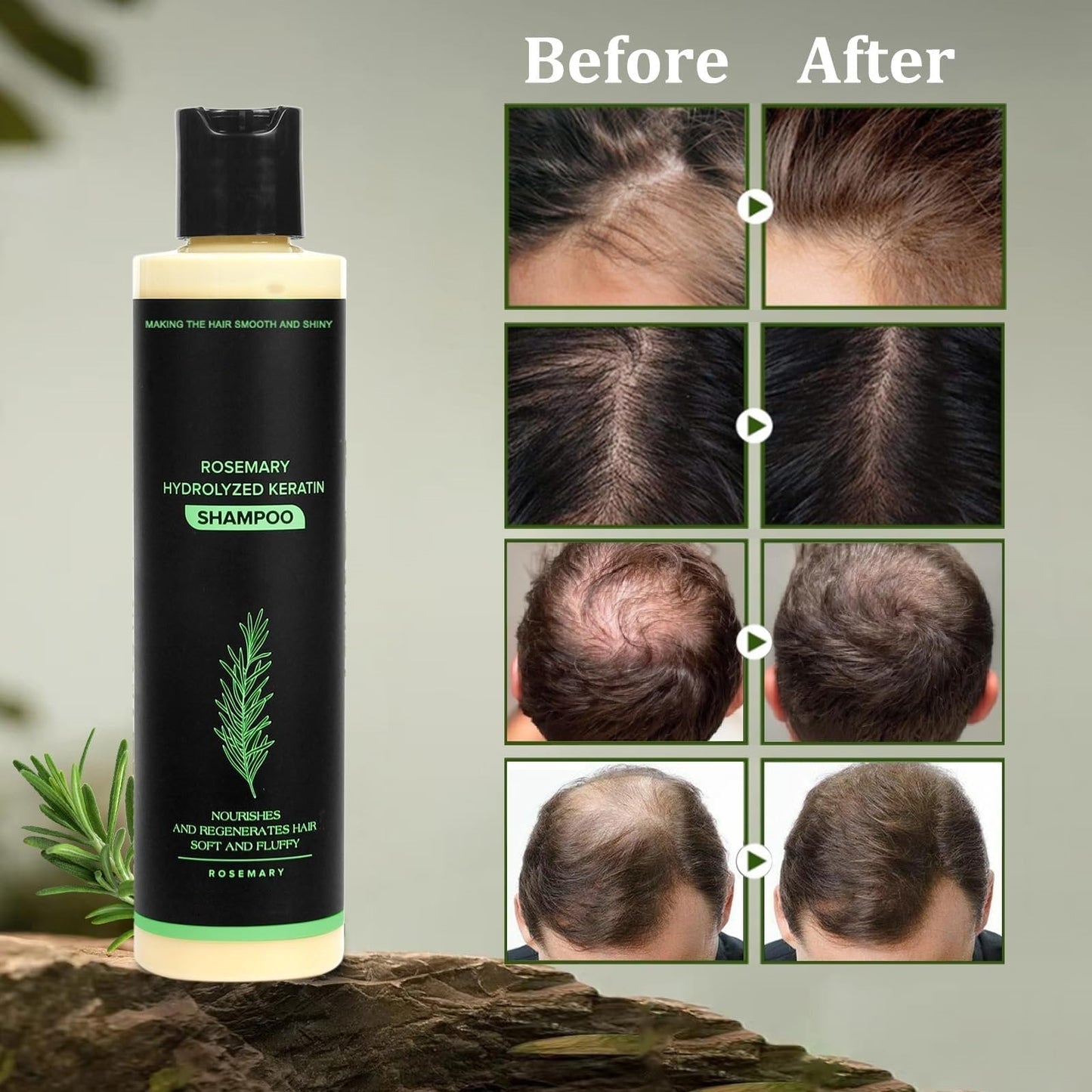 👑2026✨LAST DAY SALE 70% OFF!🏆Organic Rosemary Hair Growth Shampoo