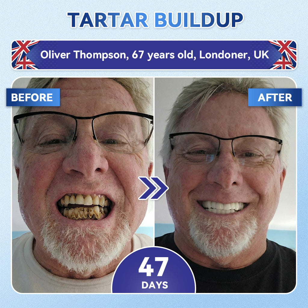 🦷 Tideglusib Fast‑Dissolving Tooth & Gum Repair Oral Strips 💥🎉 (Supports tooth repair and helps relieve gum discomfort and other common oral concerns)