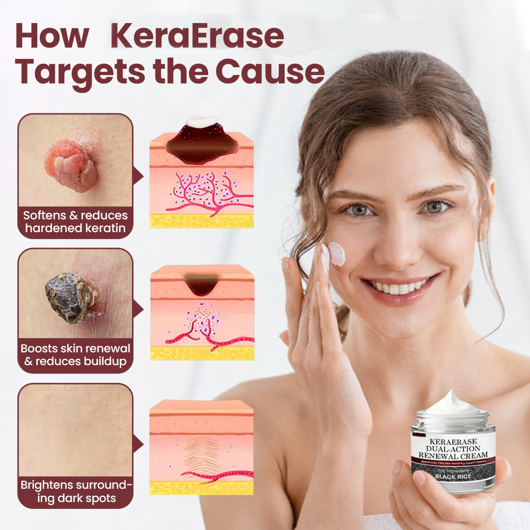 KeraErase Dual-Action Renewal Cream
