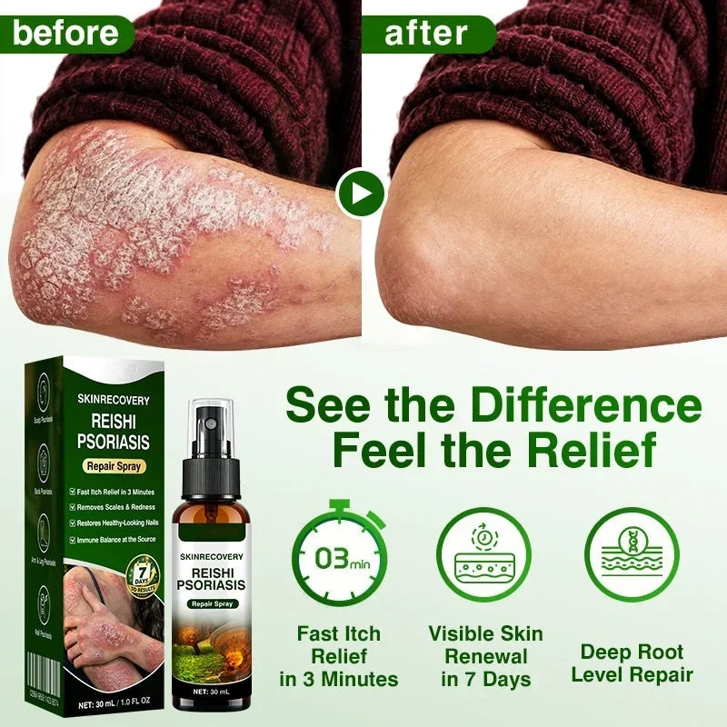 🇺🇸🏆👨‍⚕️✅SkinRecovery Reishi Psoriasis Repair Spray