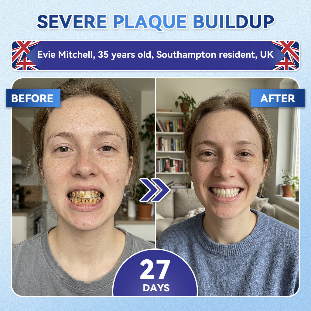 🦷 Tideglusib Fast‑Dissolving Tooth & Gum Repair Oral Strips 💥🎉 (Supports tooth repair and helps relieve gum discomfort and other common oral concerns)