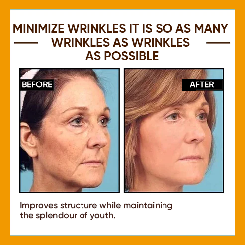 🔥2026, Exclusive premium COMPLEX technology and sophisticated design 2-minute wrinkle-reducing serum( ✅ Permanently removes wrinkles in 3 minutes ✅ )