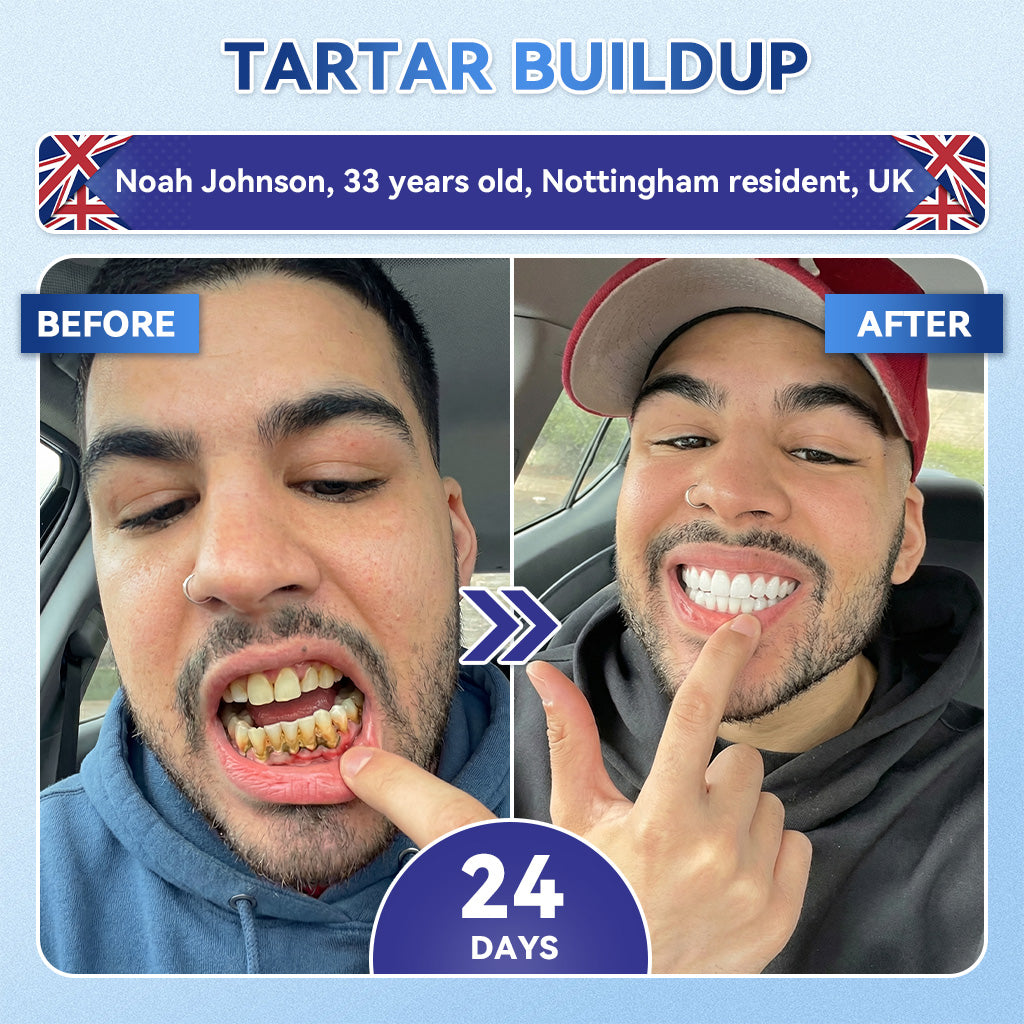 🦷 Tideglusib Fast‑Dissolving Tooth & Gum Repair Oral Strips 💥🎉 (Supports tooth repair and helps relieve gum discomfort and other common oral concerns)