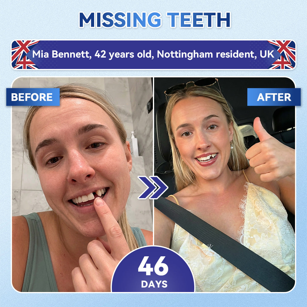 🦷 Tideglusib Fast‑Dissolving Tooth & Gum Repair Oral Strips 💥🎉 (Supports tooth repair and helps relieve gum discomfort and other common oral concerns)