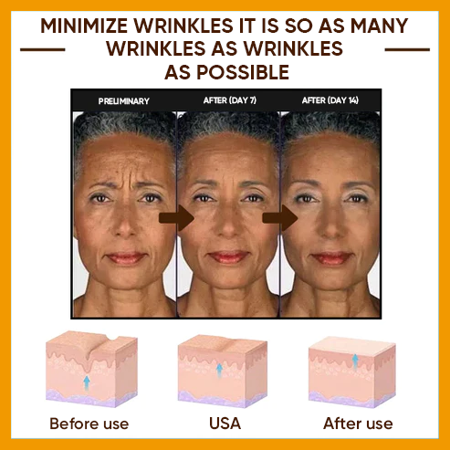 🔥2026, Exclusive premium COMPLEX technology and sophisticated design 2-minute wrinkle-reducing serum( ✅ Permanently removes wrinkles in 3 minutes ✅ )