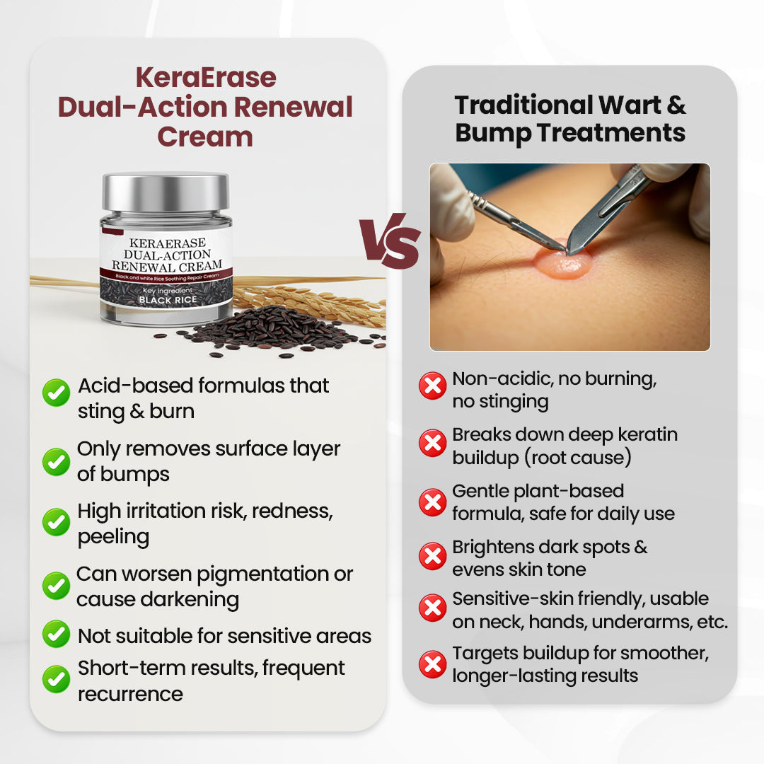 KeraErase Dual-Action Renewal Cream
