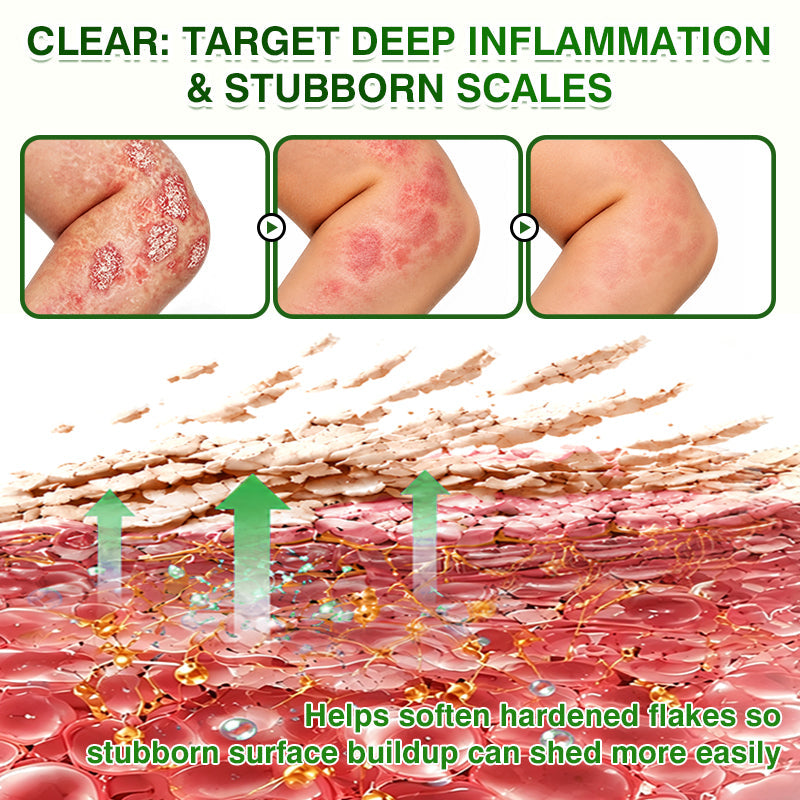 🇺🇸🏆👨‍⚕️✅SkinRecovery Reishi Psoriasis Repair Spray