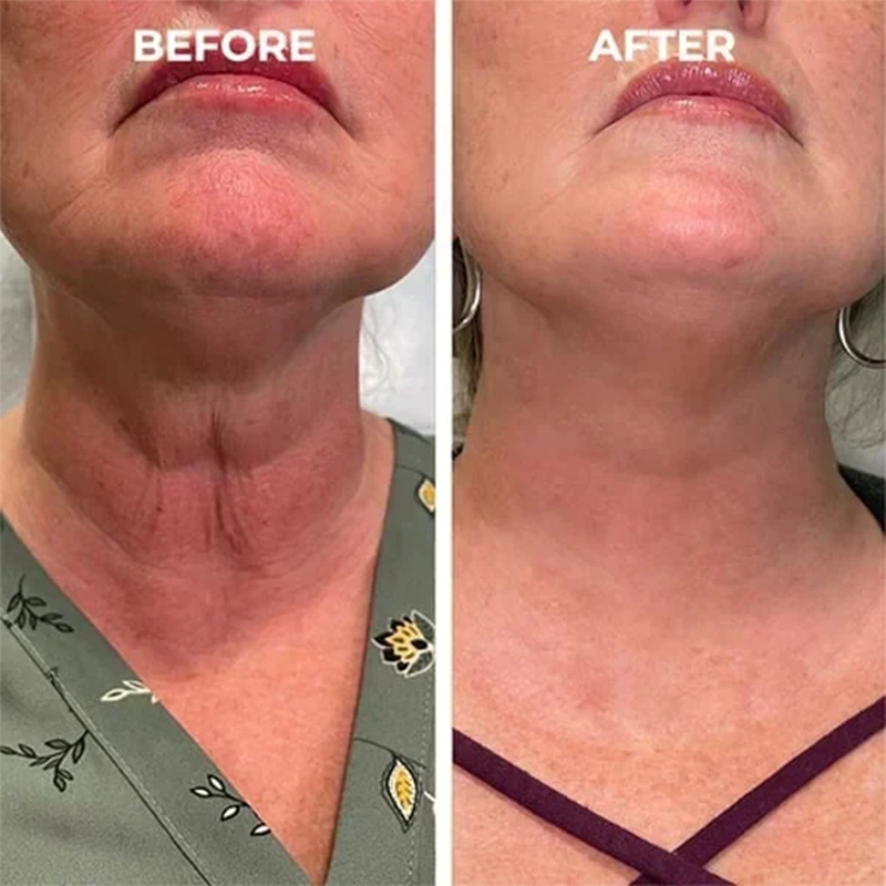 🔥2026, Exclusive premium COMPLEX technology and sophisticated design 2-minute wrinkle-reducing serum( ✅ Permanently removes wrinkles in 3 minutes ✅ )