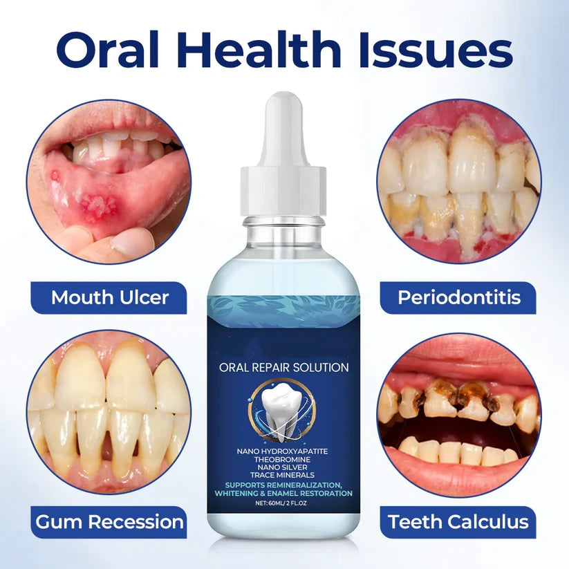 💥New on sale 2026 💞Oral Repair Solution