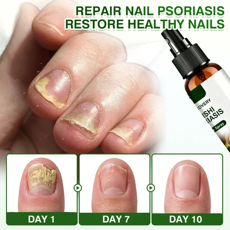 🇺🇸🏆👨‍⚕️✅SkinRecovery Reishi Psoriasis Repair Spray