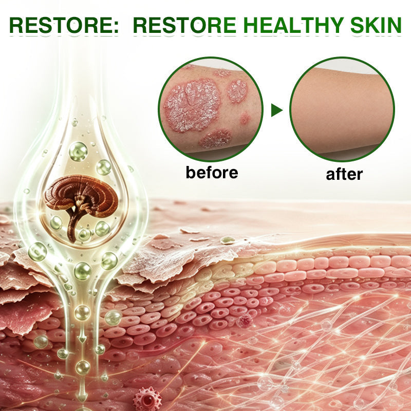 🇺🇸🏆👨‍⚕️✅SkinRecovery Reishi Psoriasis Repair Spray