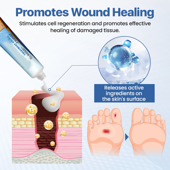 Diabetes Treatment Cream