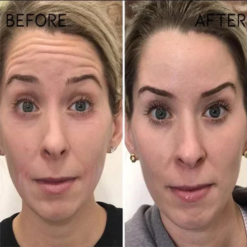 🔥2026, Exclusive premium COMPLEX technology and sophisticated design 2-minute wrinkle-reducing serum( ✅ Permanently removes wrinkles in 3 minutes ✅ )