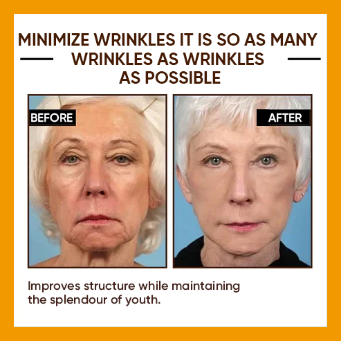 🔥2026, Exclusive premium COMPLEX technology and sophisticated design 2-minute wrinkle-reducing serum( ✅ Permanently removes wrinkles in 3 minutes ✅ )