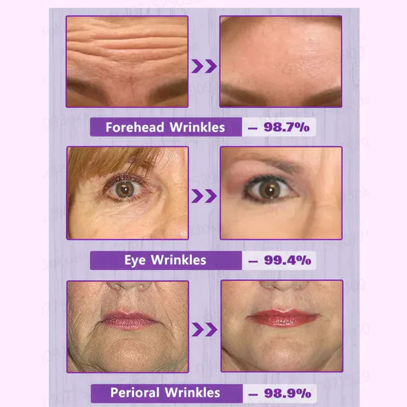 🔥2026, Exclusive premium COMPLEX technology and sophisticated design 2-minute wrinkle-reducing serum( ✅ Permanently removes wrinkles in 3 minutes ✅ )