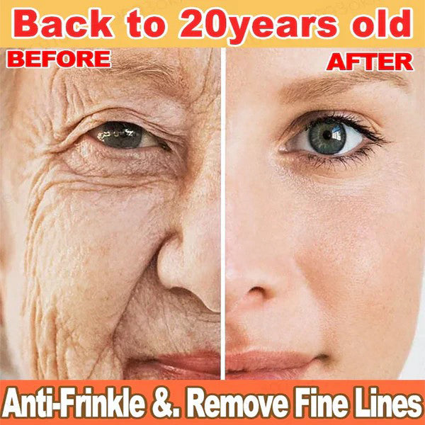 🔥2026, Exclusive premium COMPLEX technology and sophisticated design 2-minute wrinkle-reducing serum( ✅ Permanently removes wrinkles in 3 minutes ✅ )