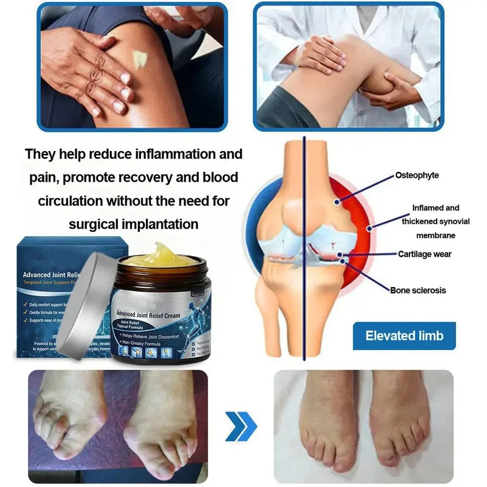 💥Buy 1 Get 1 Free 💕- Advanced Anti-Aging Joint Relief Cream