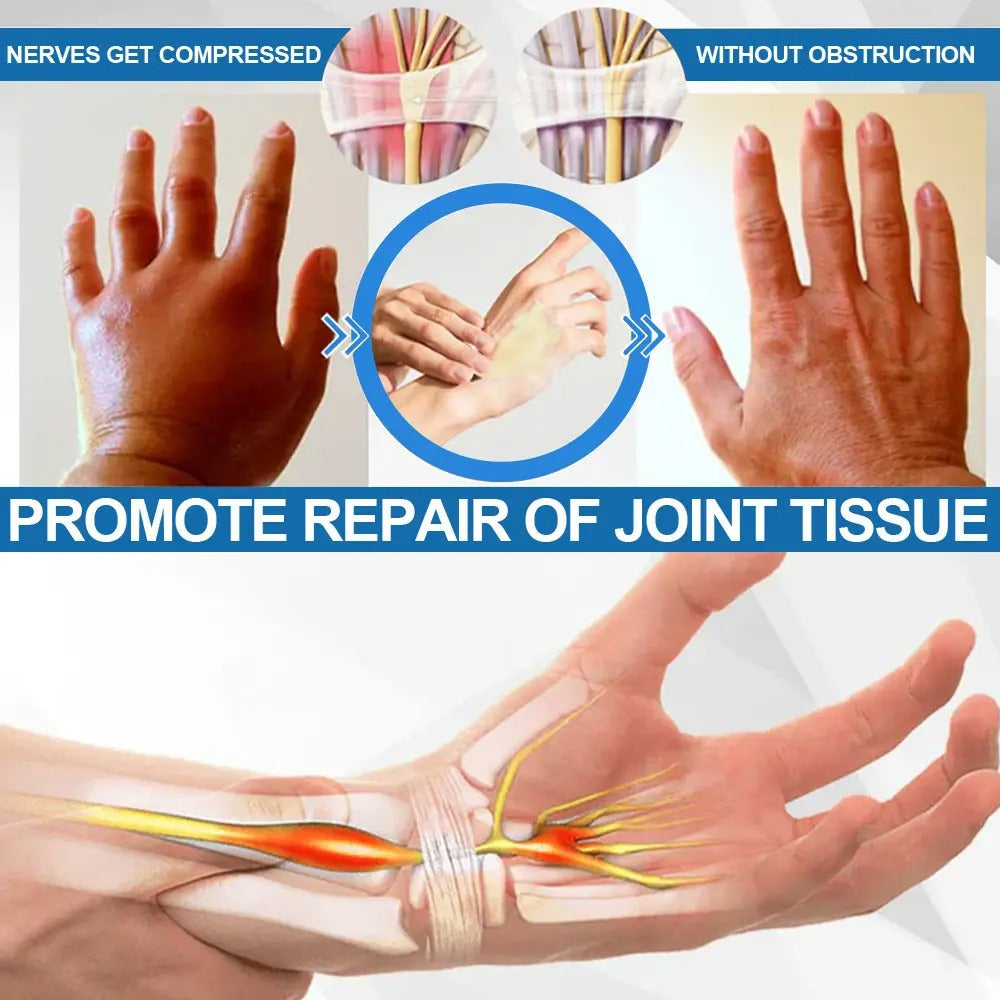 💥Buy 1 Get 1 Free 💕- Advanced Anti-Aging Joint Relief Cream